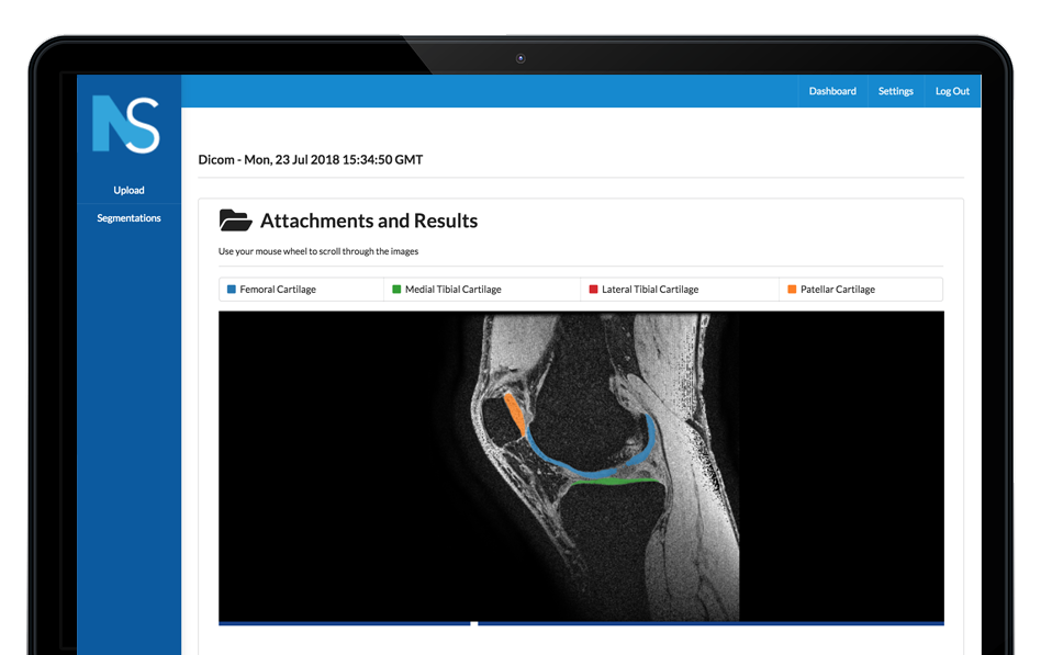 neuralseg portfolio